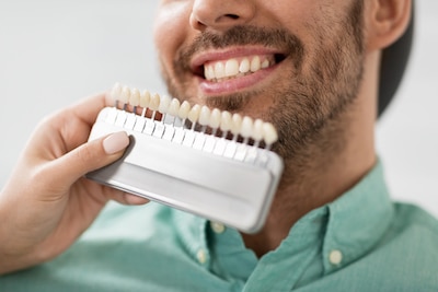 man's face with veneers being held to compare colors